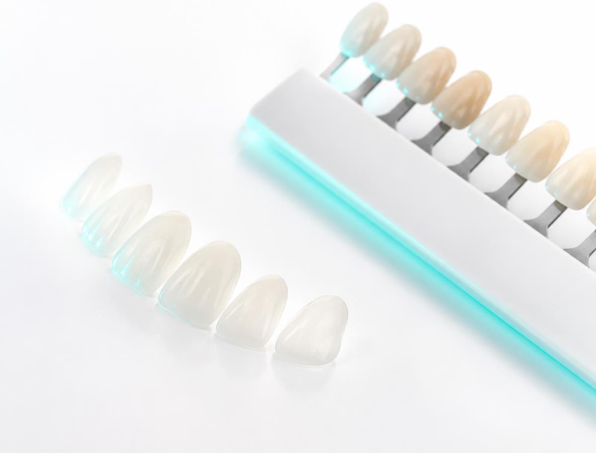 Estética dental
